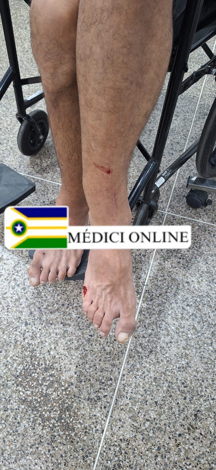 Acidente entre motociclista e ciclista deixa feridos na Rua da Saudade