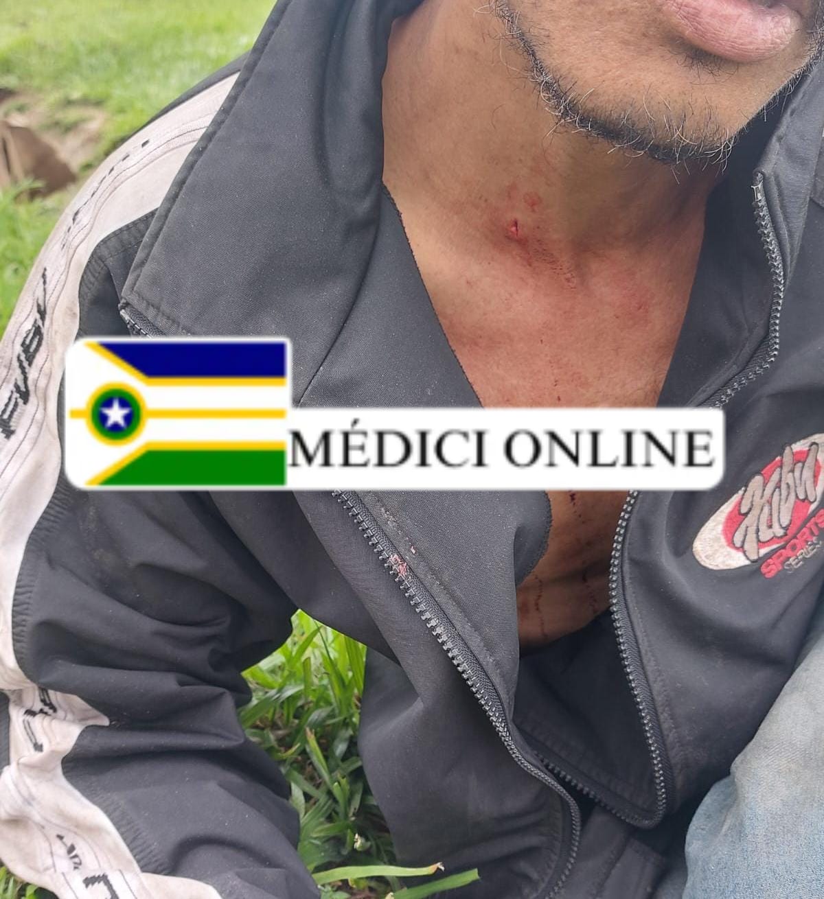 Homem cai de bicicleta e vergalhão perfura seu pescoço na Avenida 30 de Junho