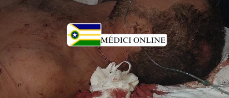 Homem é esfaqueado após briga familiar motivada por ciúmes em Presidente Médici