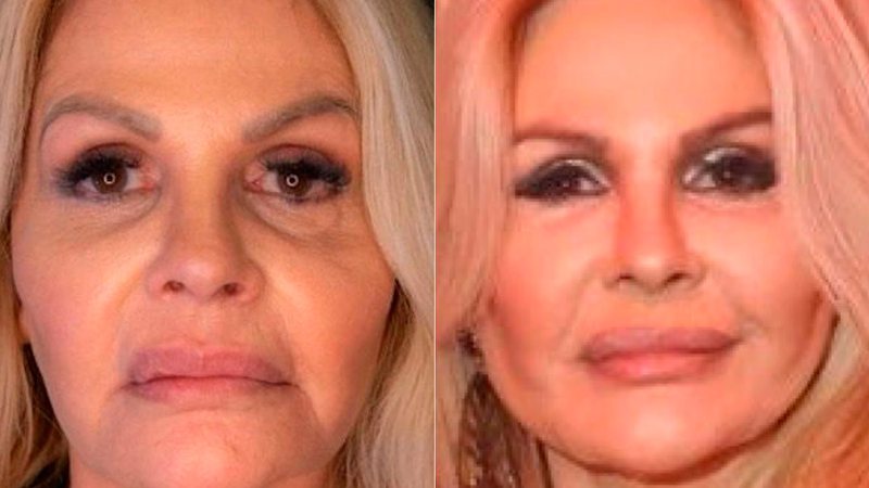 MONIQUE EVANS EXPLICA “BOCA TORTA” AO MOSTRAR HARMONIZAÇÃO FACIAL